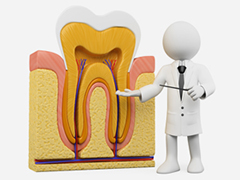 深刻なむし歯、重度のむし歯では根管治療で対応